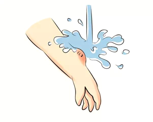 宝宝骨折了如何急救,宝宝骨折恢复过程中的四大禁忌