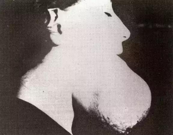 这种物质曾被当作保健成分，受害者的遗骨因此发光上千年