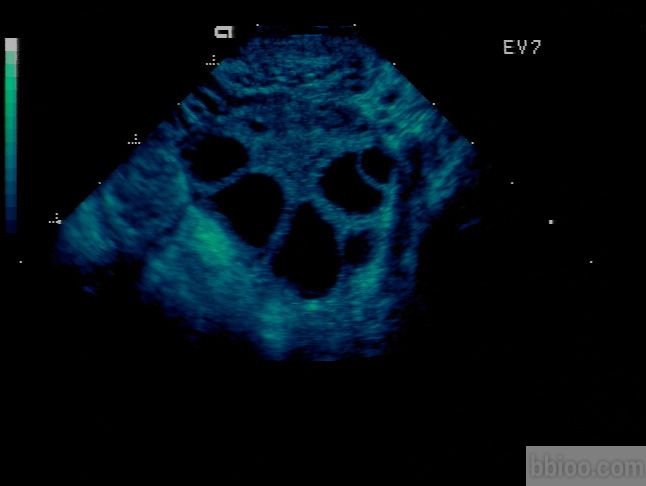 想要一个“好卵泡”你该怎么做？祝好孕