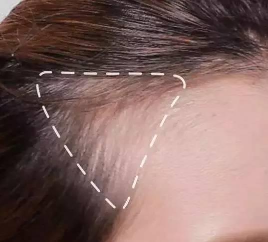 大幂幂凸显发际线,大幂幂发际线高