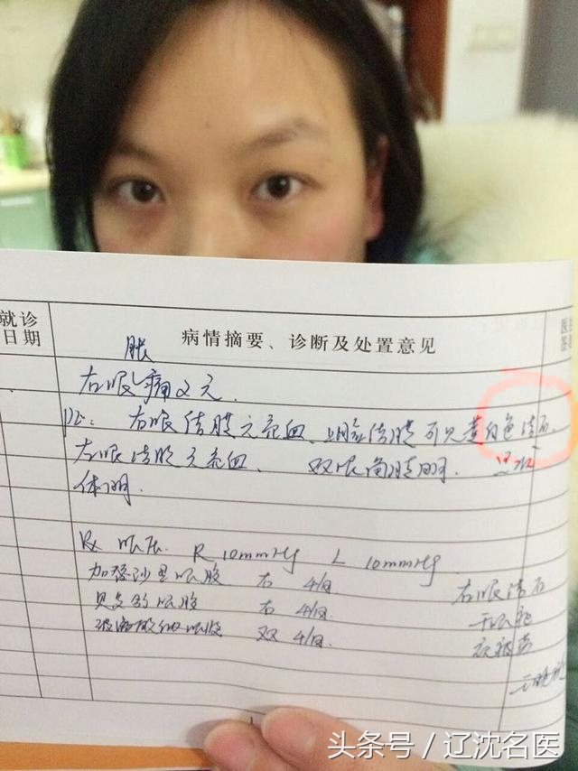 追剧、戴美瞳，女孩上眼皮长满“结石”，医生一针针刺破救眼睛