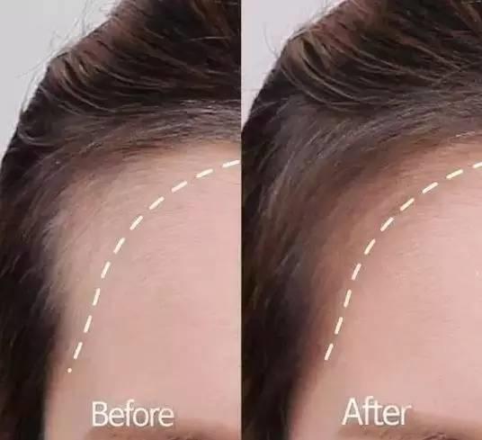 大幂幂凸显发际线,大幂幂发际线高