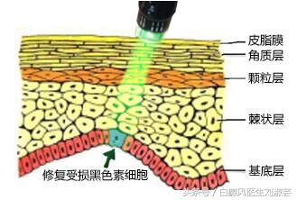 白癜风能自愈吗视频,白癜风能治愈吗白癜风怎么引起的