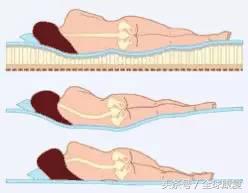 l45椎间盘突出的康复训练方法,c3-7椎间盘突出康复训练