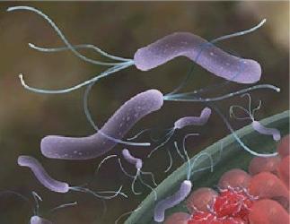 肠胃溃疡总是复发,十二指肠溃疡久治不愈会恶化吗