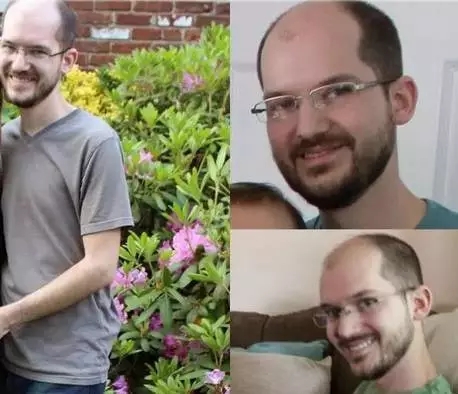 男人服用大量雄性激素会怎么样,男生长期服用雌性激素会怎么样