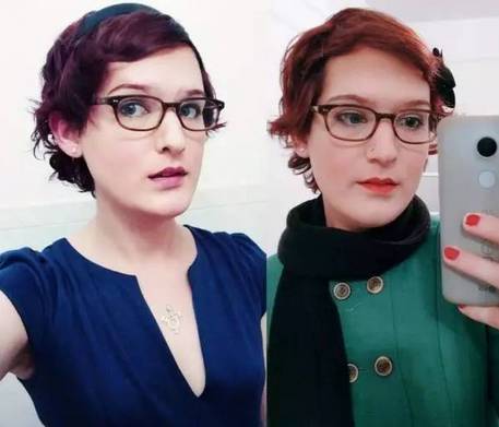 男人服用大量雄性激素会怎么样,男生长期服用雌性激素会怎么样