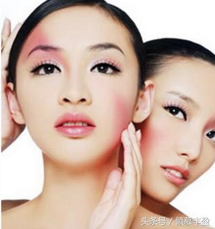 咽部红有血丝是什么原因,常年红血丝是什么原因