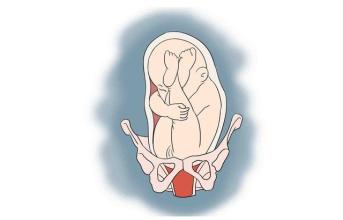 顺产报销需要准备什么东西,想要顺产的条件