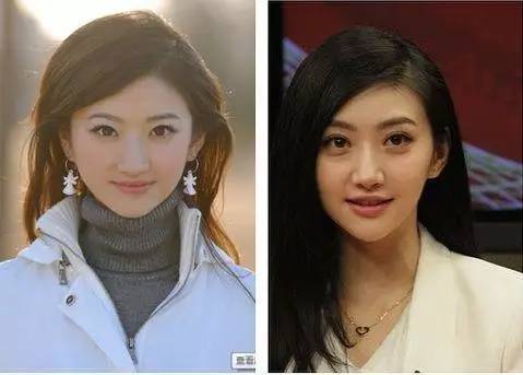 双眼皮怎么割没肉条感,双眼皮怎么显得更宽