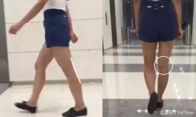 粗小腿怎么变细,粗小腿改善