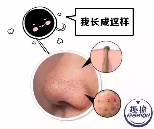 angelababy痘痘,angelababy额头冒巨痘