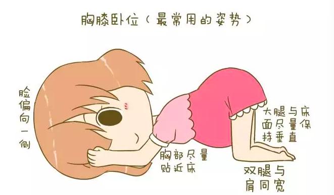 胎位不正漫步有利于转正胎位吗,胎位不正医生手动转正胎位