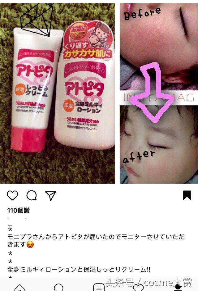 推荐一款适合宝宝用于湿疹的好物,湿疹妈妈们有什么灵丹妙药推荐