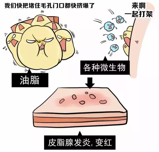 angelababy痘痘,angelababy额头冒巨痘