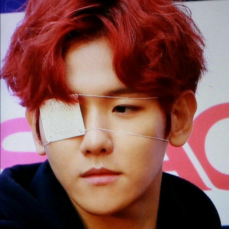 眼麦粒肿中医最快消除办法,中医治疗麦粒肿怎么治疗好得快