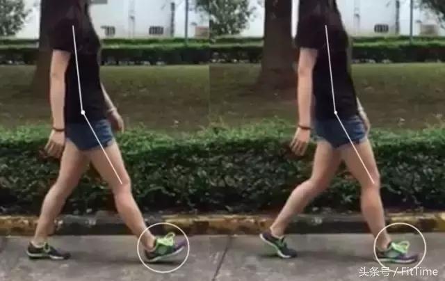 粗小腿怎么变细,粗小腿改善