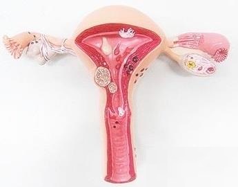 卵巢早衰彩超显示卵巢小怎么调理,子宫卵巢衰老能治吗