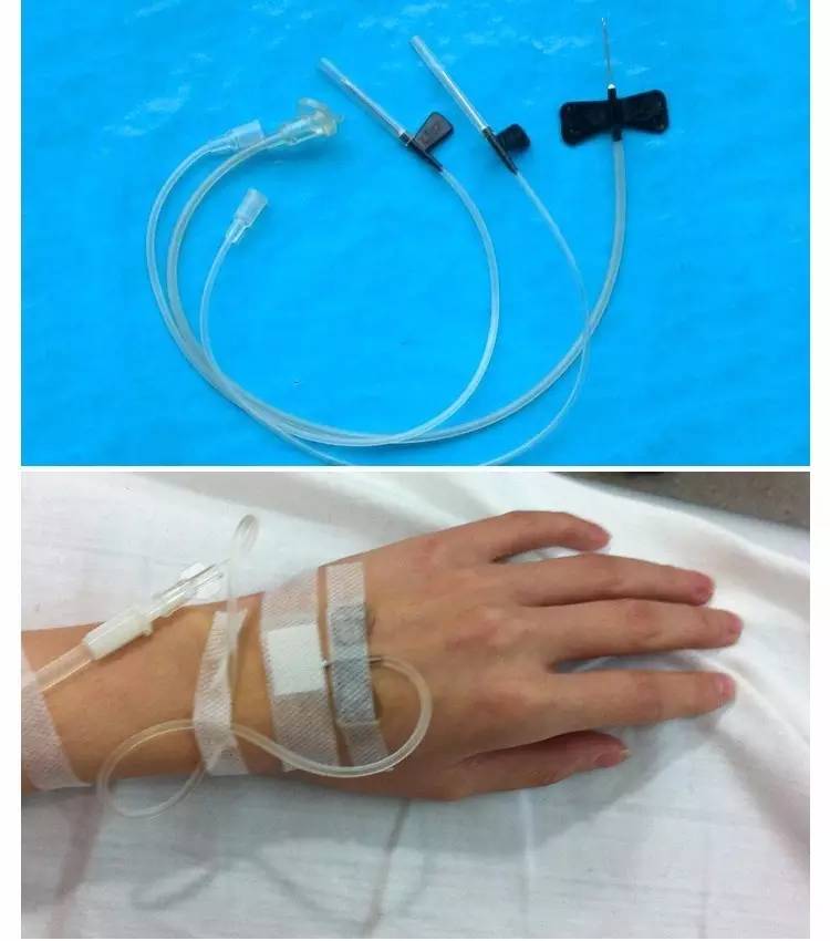 宝宝输液用留置针好还是钢针好,输液扎针时用软针管好吗