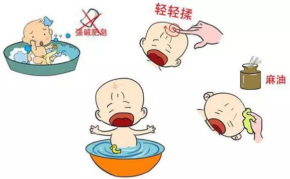 新生儿需要关注的事项和保养,新生儿照顾重点