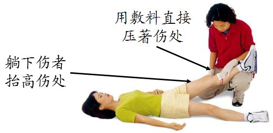 大动脉出血能止住吗,大动脉出血是怎么样