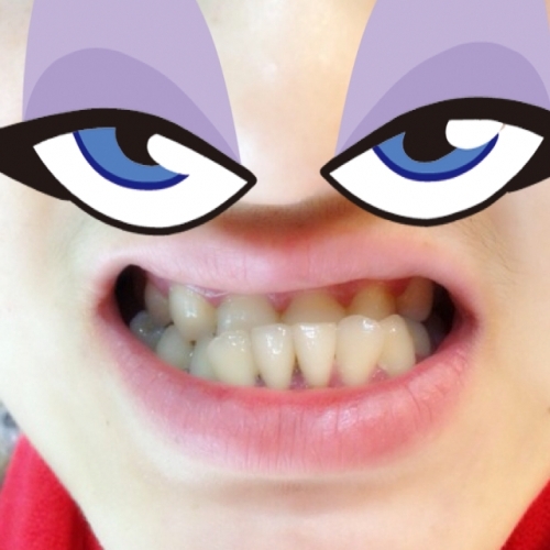 小孩牙齿地包天的原因,牙齿地包天是什么原因造成的