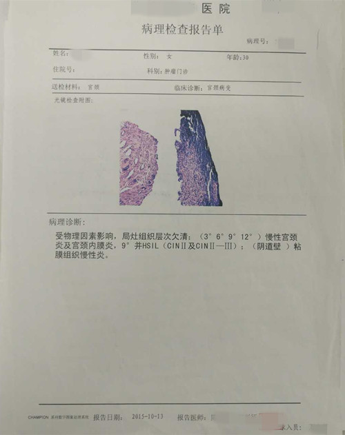 宫颈疾病方面病例分析,临床诊断宫颈病变怎么治疗