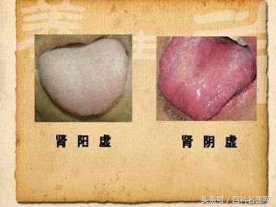 你是肾阴虚还是肾阳虚,中医怎么判断阴虚还是阳虚