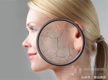 脸到春天就起皮是咋回事,春天手起皮怎么治疗