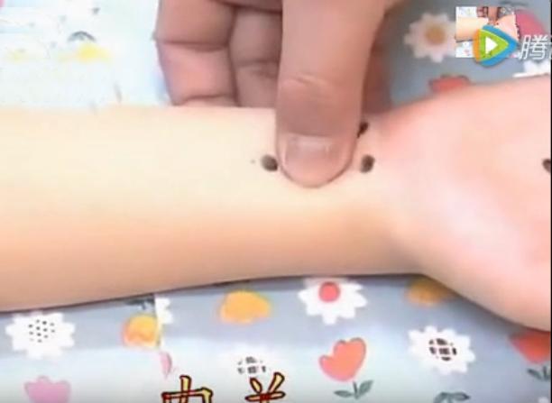 湘西点穴治疗脑瘫的名医,小儿脑瘫推拿疗法