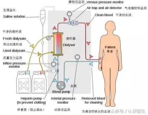 透析病人钙低磷高pth高怎么解决,透析患者血磷升高是怎么回事