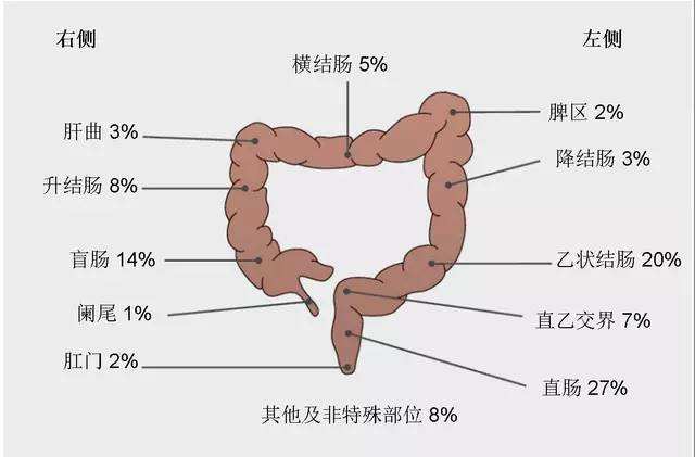 肠癌最忌讳的食物,肠癌神奇自愈中草药