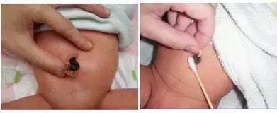 新生儿需要关注的事项和保养,新生儿照顾重点