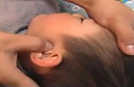 湘西点穴治疗脑瘫的名医,小儿脑瘫推拿疗法