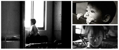 鲜红斑痣加重的三个时期,头上鲜红斑痣得sw综合征的几率