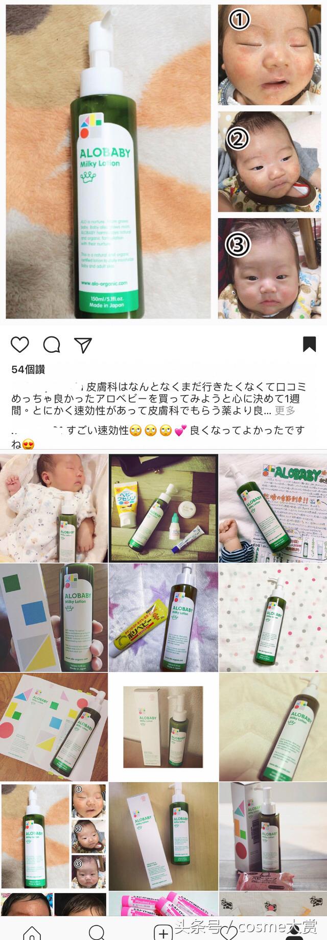 推荐一款适合宝宝用于湿疹的好物,湿疹妈妈们有什么灵丹妙药推荐