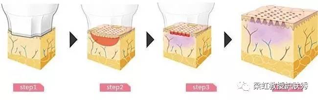 雀斑中性风妆容,简单又好看的雀斑妆