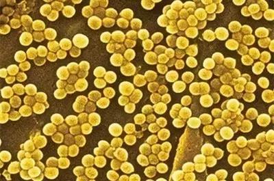 30岁之后关节会快速退化，有这6个习惯的人一定要谨慎！