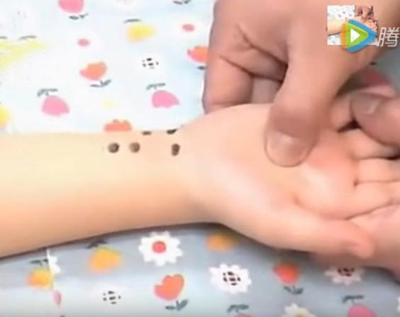 湘西点穴治疗脑瘫的名医,小儿脑瘫推拿疗法