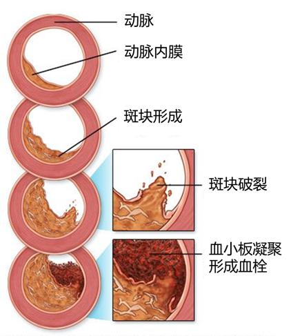 特朗普70岁后的变化,特朗普70岁