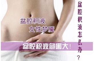 看到盆腔积液先别怕，可能并没有什么事！