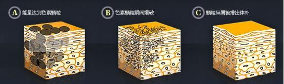 纹身可以遮盖老纹身吗,如何用纹身遮盖旧纹身