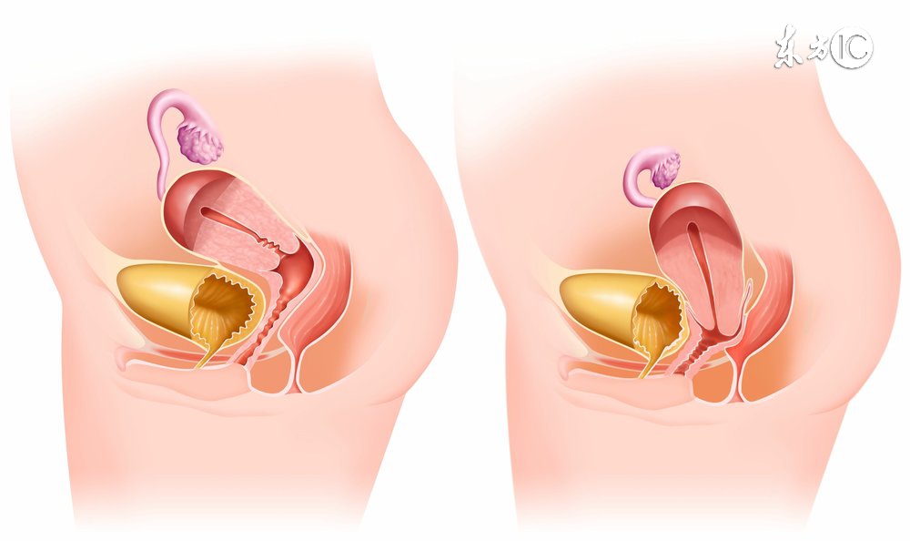 想到那位在家等死的宫颈癌患者，我就痛心不已癌症并不那么可怕
