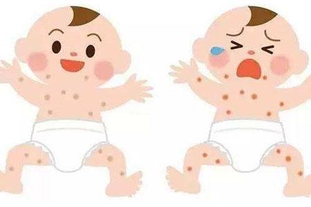 春季湿疹高发，宝宝预防湿疹关注点啥？