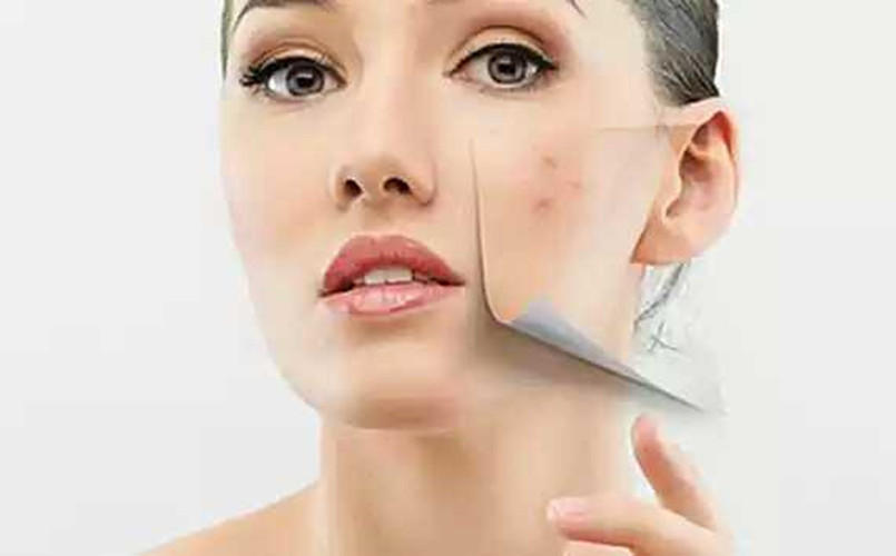 你为什么一直长痘痘呢？你也许轻忽了这些