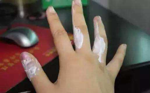 小孩脚背烫伤有什么好方法,宝宝脚烫伤后期护理