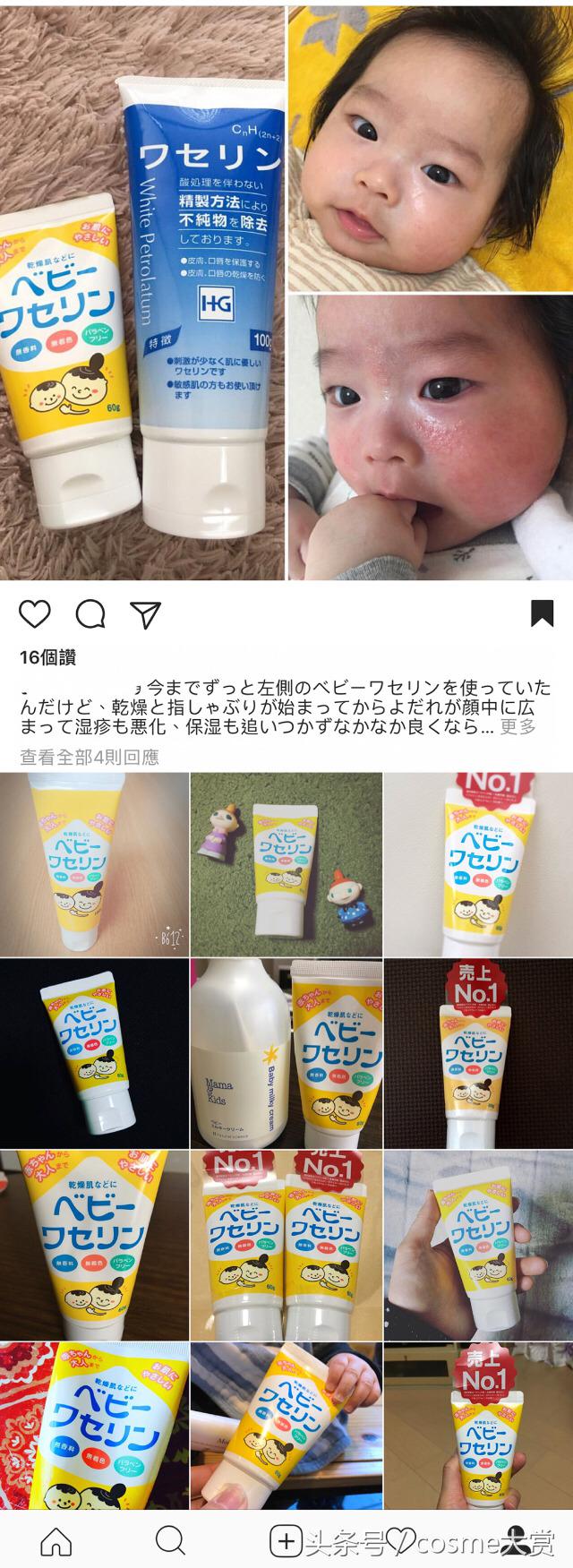 推荐一款适合宝宝用于湿疹的好物,湿疹妈妈们有什么灵丹妙药推荐