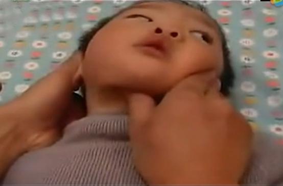 湘西点穴治疗脑瘫的名医,小儿脑瘫推拿疗法