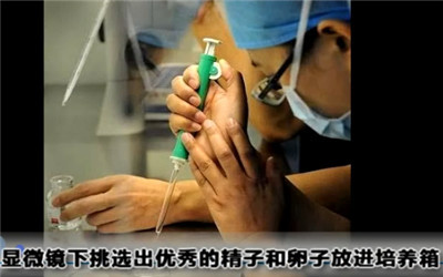 做试管婴儿手术身体是不是很遭罪,人工授精遭罪还是试管婴儿遭罪