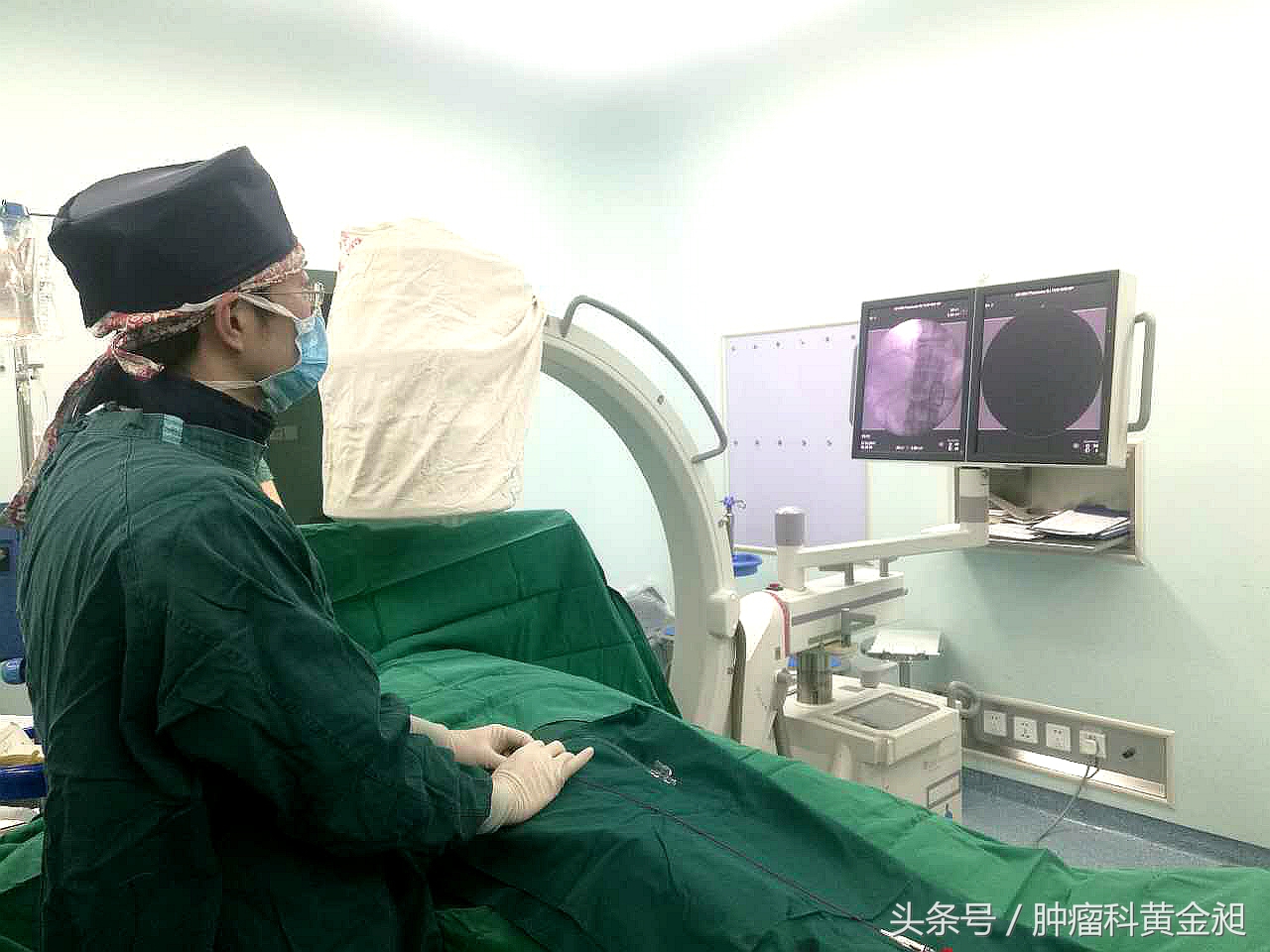 肝癌介入栓塞化疗的副作用,肿瘤介入手术栓塞血管